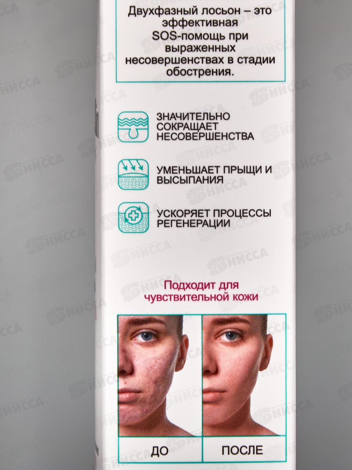 Clean Skin Лосьон SOS-помощь Чистая кожа 50мл *14